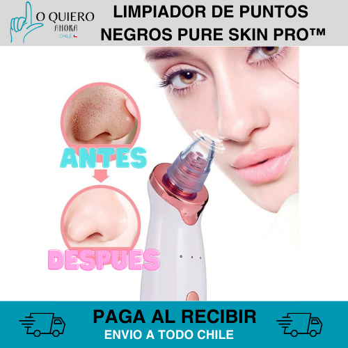 Limpiador puntos Negros  PURE SKIN PRO™